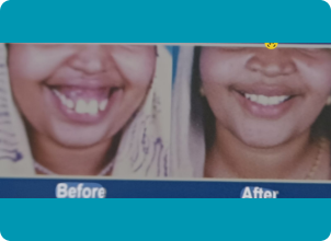 Jaw Correction Surgery