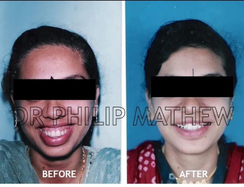 Facial Plastic Surgery